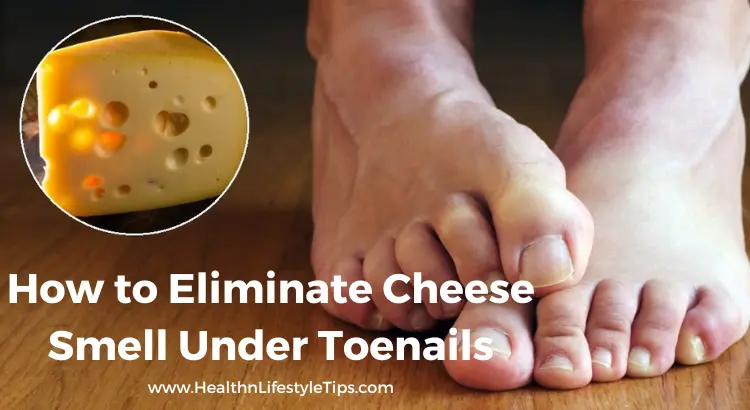 how-to-get-rid-of-cheese-smell-under-toenails